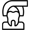 Pericoronitis